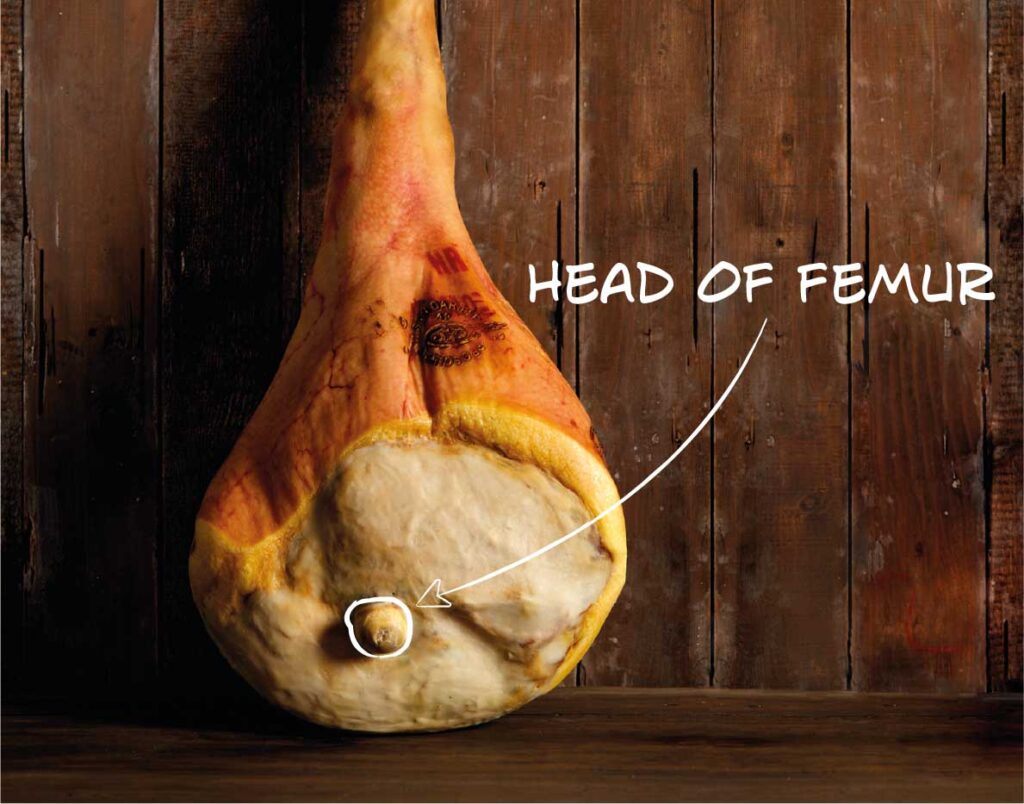 Head of femur